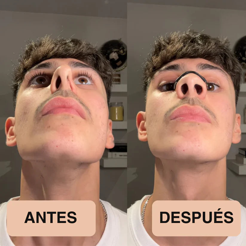 Kit Respira Mejor ForceLab™ – Tiras Magnéticas + Recambios (15 días)